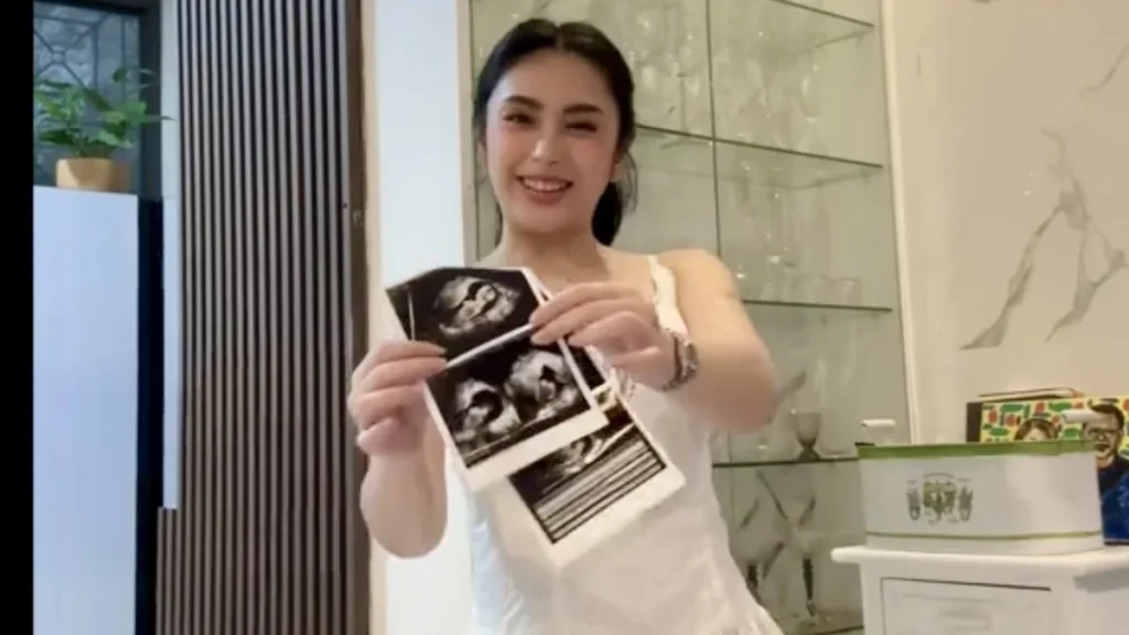 image of bea borres mom era mula pagbubuntis hanggang sa pagiging ina