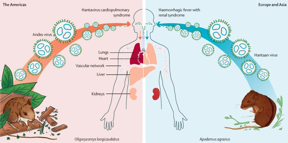 image of understanding hantavirus and its risks